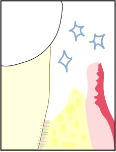 再生療法イラスト２