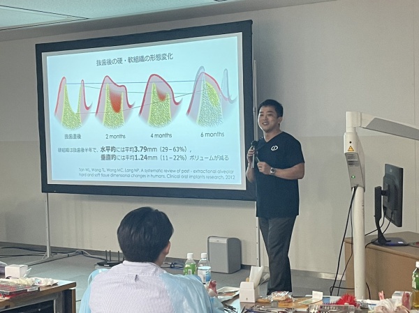 歯ぐき下がり　歯茎　根面被覆